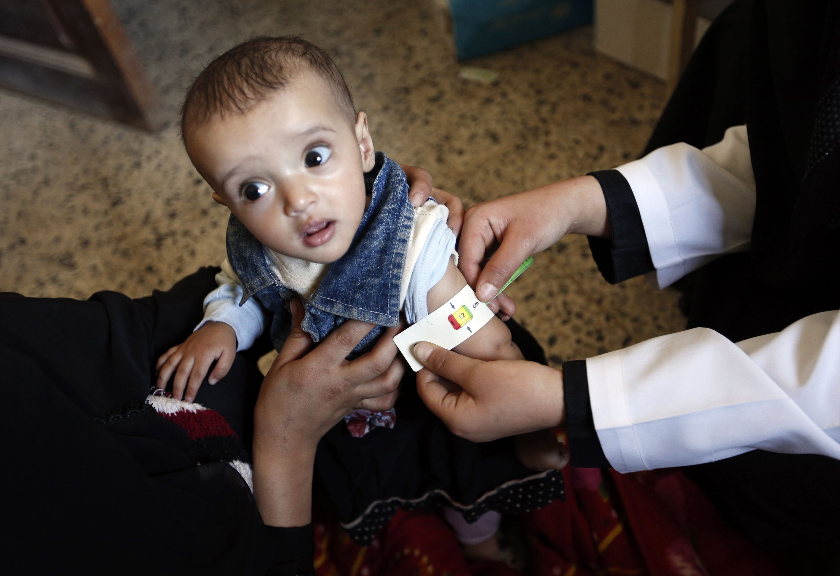Durch sogenannte Screenings kann schnell festgestellt werden, ob ein Kind Behandlung gegen Mangelernährung benötigt. Foto: Mohammed Huwais/AFP