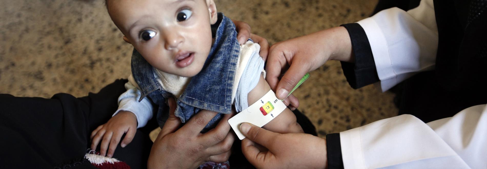 Untersuchung eines Kindes im Jemen auf Mangelernährung. Foto: Mohammed Huwais/AFP