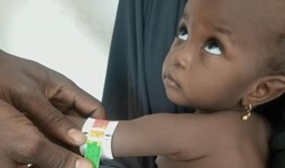 Hussaina, eine kleine nigerianische Patientin, wird auf Mangelernährung untersucht. Foto: Ärzte der Welt