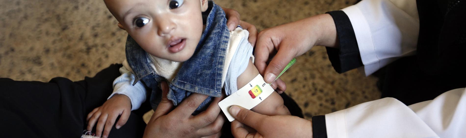 Untersuchung eines Kindes im Jemen auf Mangelernährung. Foto: Mohammed Huwais/AFP