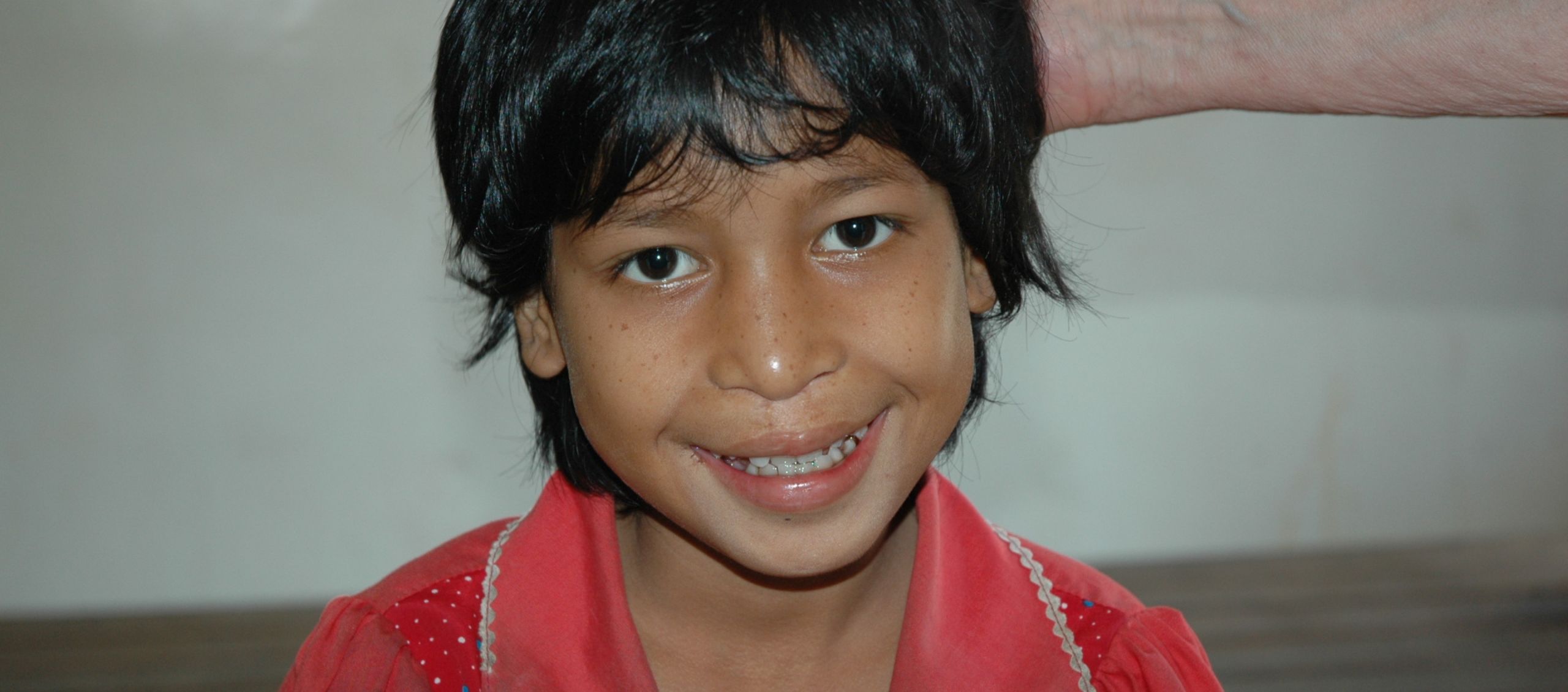 Ein lächelndes Kind nach einer erfolgreichen Lippen-Kiefer-Gaumenspalte-Behandlung. © Ärzte der Welt