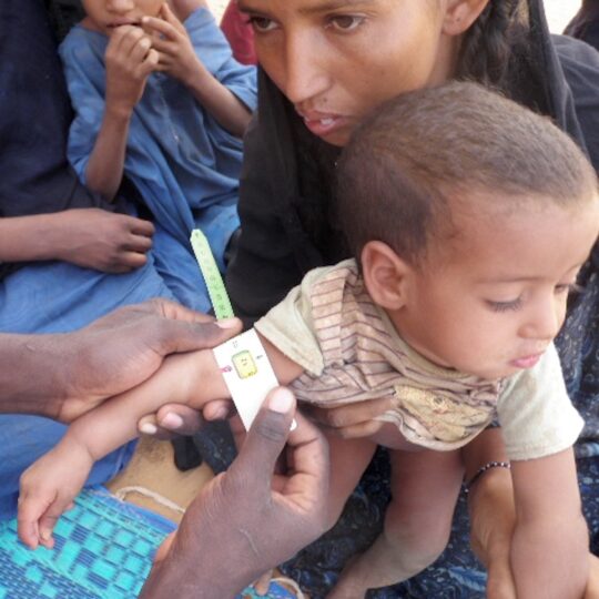 Einem kleinen Jungen wird in Mali mit einem Maßband der Armumfang gemessen.