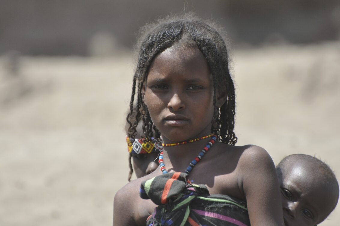 „Wir werden beschließen, die Beschneidung abzuschaffen!“