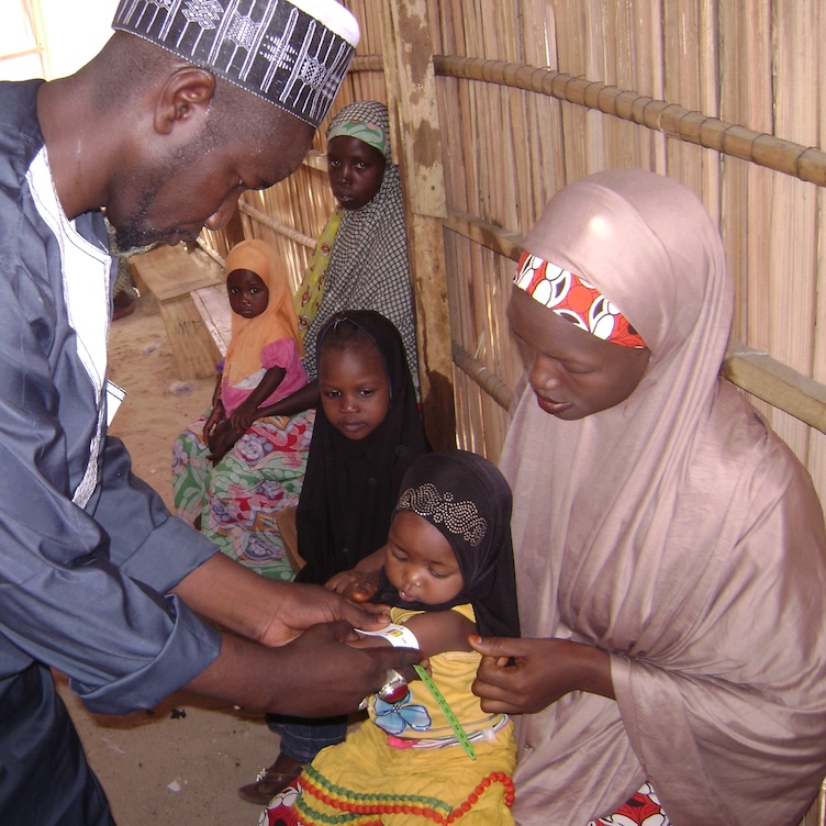 Ein Kind wird in einer Gesundheitsstation auf Unterernährung untersucht. 