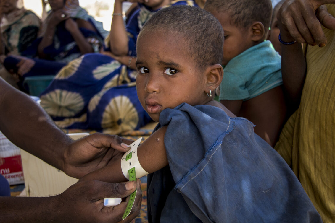 Mali: Einem kleinen Mädchen wird der Armumfang gemessen. Ärzte der Welt untersucht Kinder auf Mangelernährung. © Moussa Kalapo