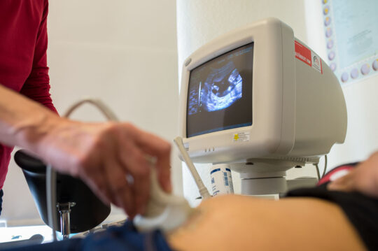 Ein Monitor zeigt das Ultraschallbild einer schwangeren Patientin in der open.med-Praxis in Hamburg. © Bente Stachowske