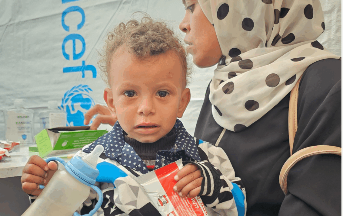 Mangelernährtes Kind in Gaza